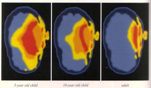 Propagation des ondes émient par les téléphones portables pour respectivement, un enfant de 5 ans, de 10 ans et un adulte.